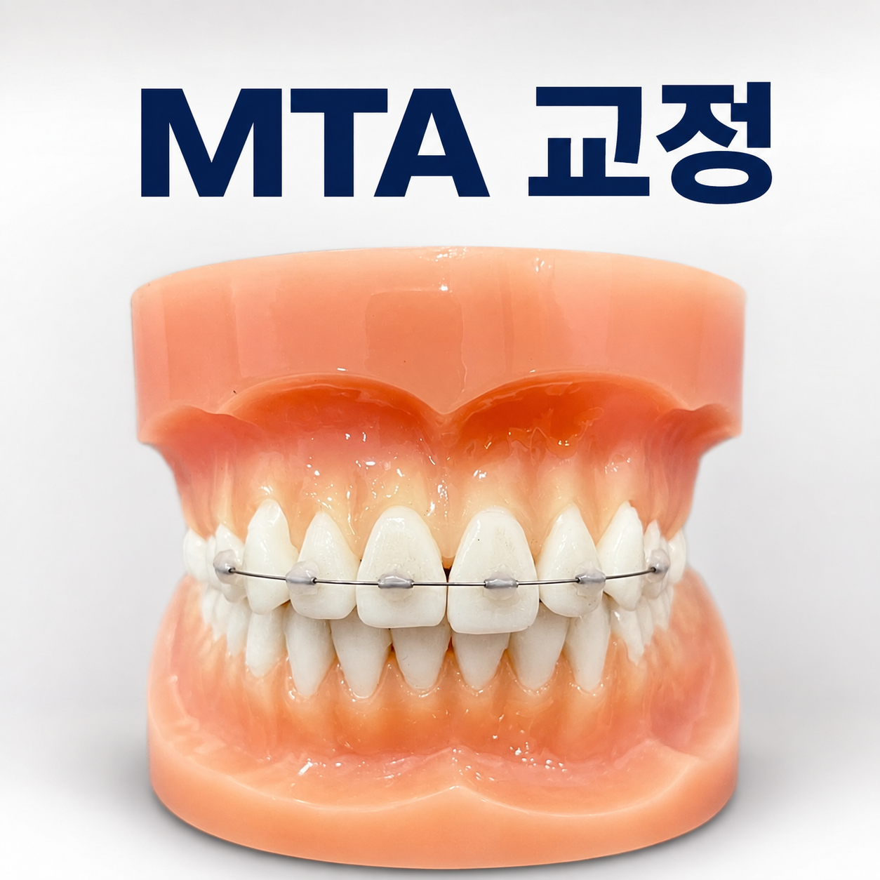 MTA 교정