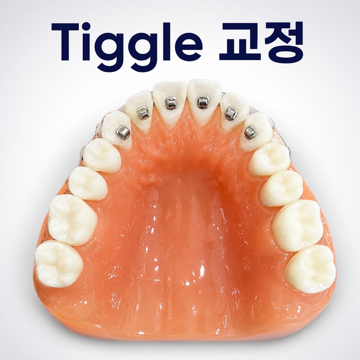 티끌 교정